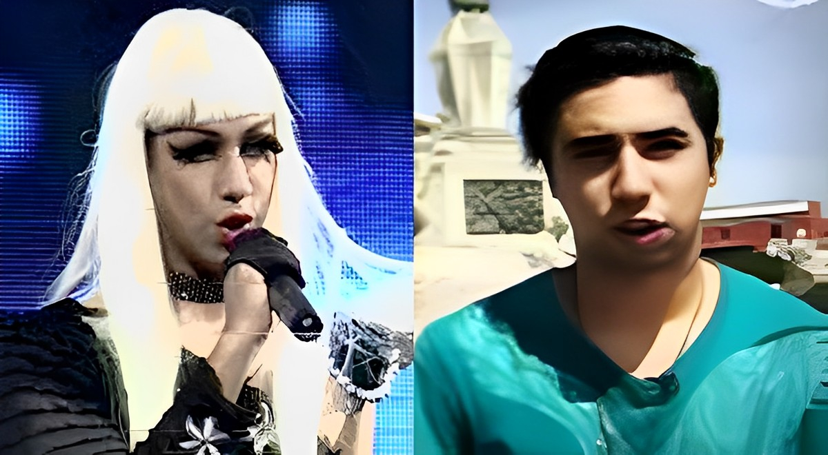 Yo Soy Imitador De Lady Gaga Podr A No Volver A Caminar Y Pide Ayuda