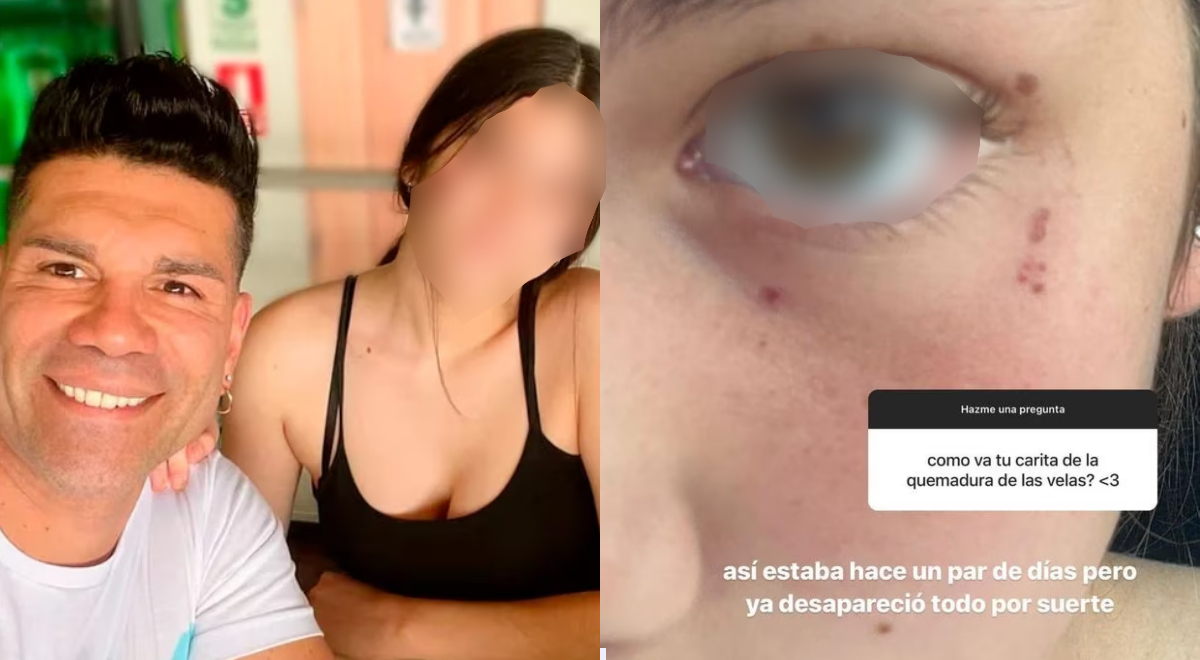 Tomate Barraza Instagram Su Hija Gaela Barraza Sufre Fuerte Accidente