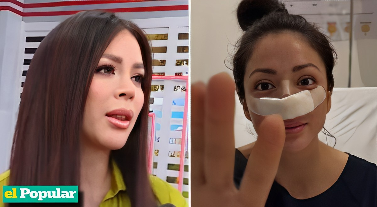 Sheyla Rojas Presume Su Nueva Nariz Y Se Jacta Toda Mala Experiencia