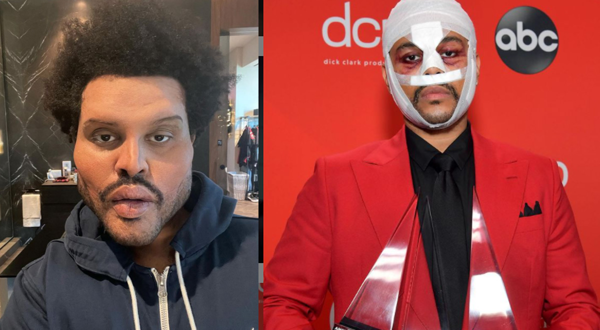 The Weeknd Sorprende Con Transformación En Su Rostro Tras Nueva Canción Save Your Tears El 4017