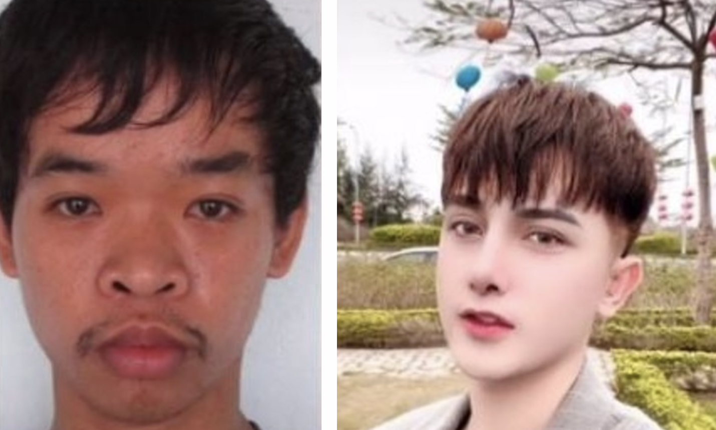 Tiktok Video Viral Joven Se Somete A Cirug As Est Ticas Y Su Incre Ble Transformaci N