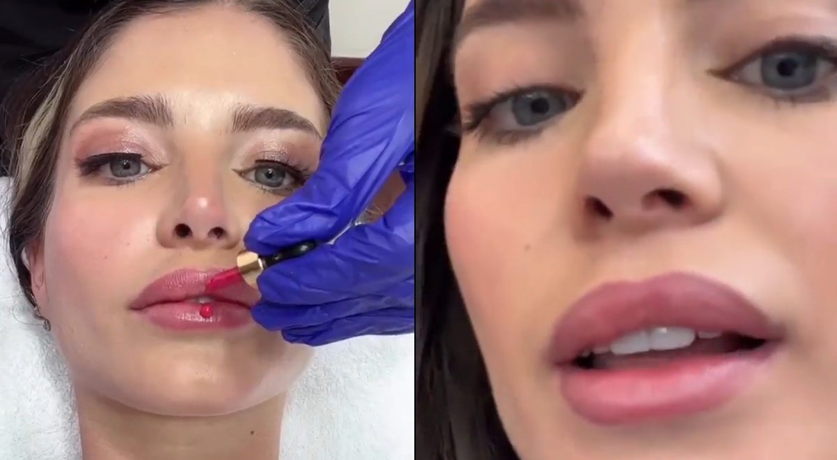 Flavia Laos Instagram Se Somete A Nuevo Retoquito En Los Labios Súper Natural Video El Popular 2792