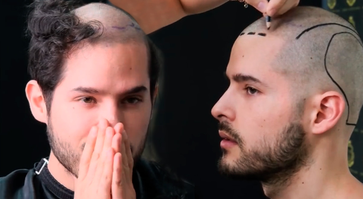 Andrés Vilchez toma una valiente decisión y se rapa la cabeza por una ...