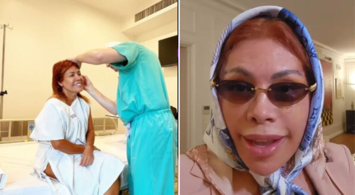 Magali Medina revela que está incomodada com a cirurgia facial e teme que interfiram novamente: “Estou tão inchada”