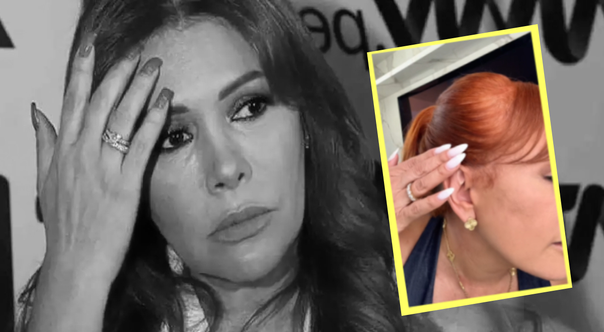 Magali Medina revela que perdeu sensibilidade nos ouvidos após cirurgia facial na Argentina: “Não vou falar…”