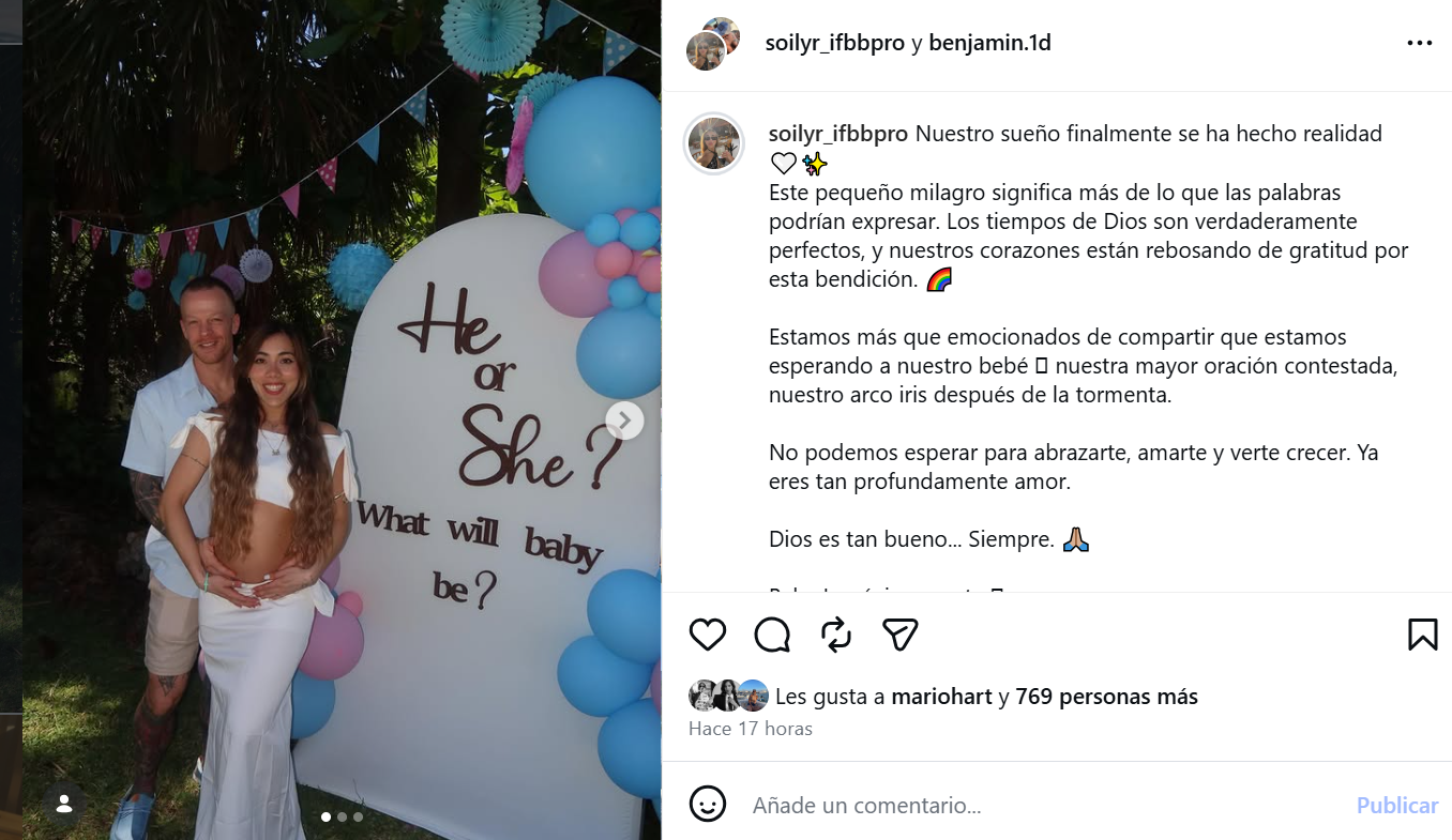 Mario Hart tiene impensada reacción a bebé en camino anunciado por Korina Rivadeneira tras su presunta separación 