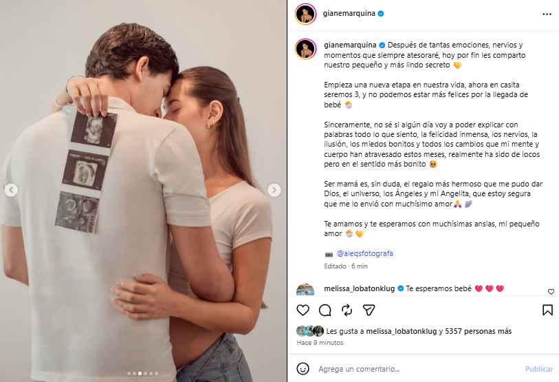 Gianella Marquina, la fille aînée de Melissa Klugin, montre son long ventre après avoir annoncé sa première grossesse : “le plus beau cadeau de Dieu”