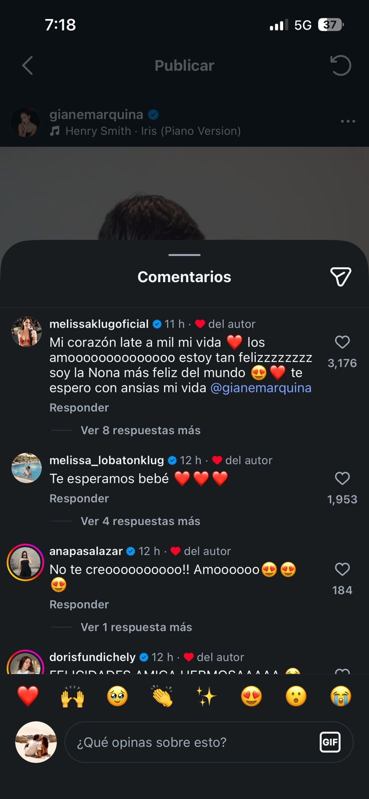 Melissa Klug réagit avec émotion à la première grossesse de sa fille aînée Gianella Marquina : “Mon cœur bat à tout rompre”