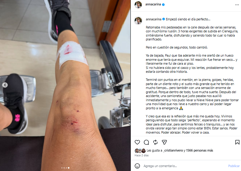 Anna Carina, la sœur de Maria Pia Coppolo, a eu un grave accident : “coups et coupures au menton et à la jambe”