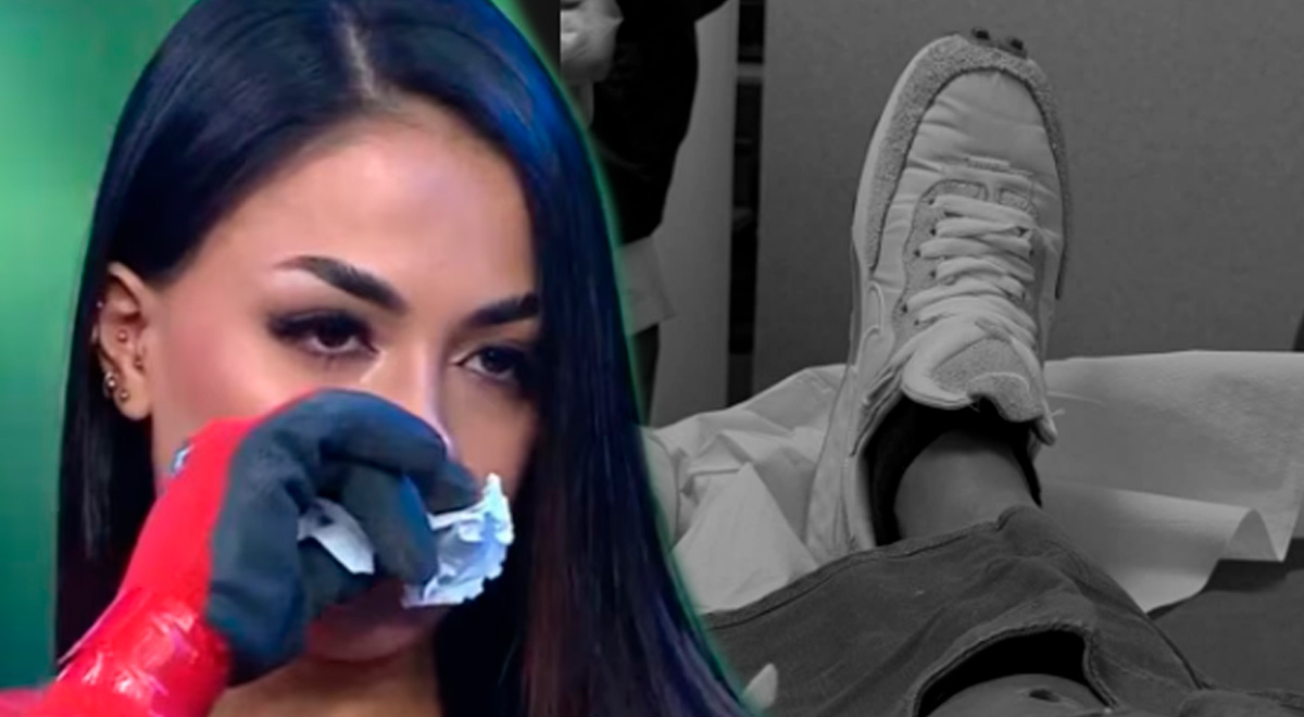 Onelia Molina a eu un grave accident et a reçu des points de suture à la jambe après avoir été blessée : “Encore une égratignure pour le tigre”